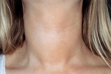 Clinical review: Hypothyroidism