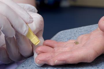 Blood tests catch diabetes too late, warn researchers