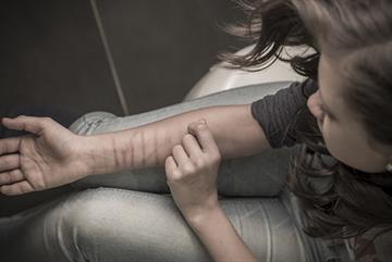 Self-harm in children and young people