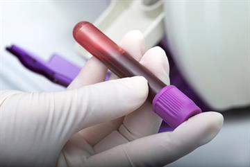 Primary biliary cirrhosis: case study