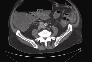 Evidence base: Ulcerative colitis