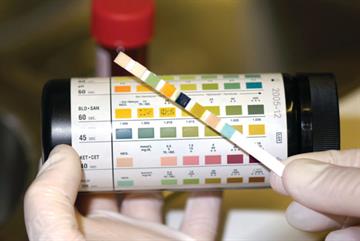 Red flag symptoms - Haematuria
