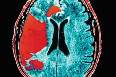 Stroke: risk was lowered with self adjusted anticoagulant dosing