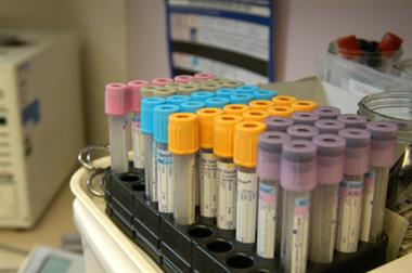 Blood samples: variation in HbA1c reduction down to genetics (photo: JH Lancy)