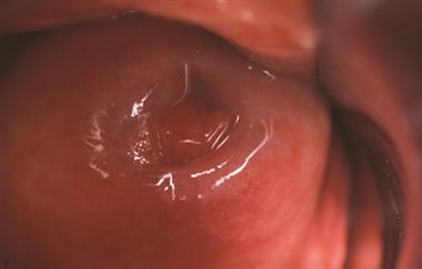 Tongue Inside Foreskin