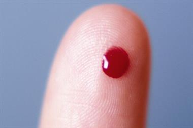 HIV: finger-prick test (Photograph: SPL)