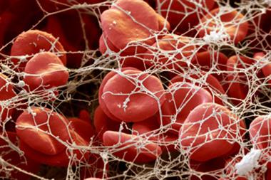 Blood clot: oral demonstrated efficacy and convenience (Photograph: SPL)