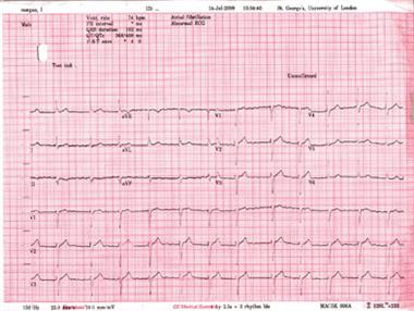 Combination therapy did not affect cardiovascular risk 
