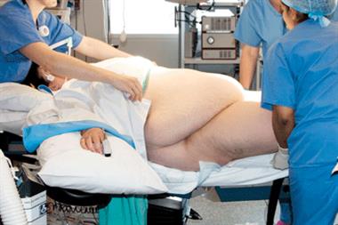 According to our survey, one in 10 of the GP funding requests are for bariatric surgery (Photograph: SPL)