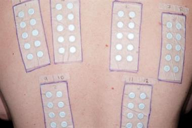 Six allergy test strips to test for allergic reactions (Photograph: SPL)