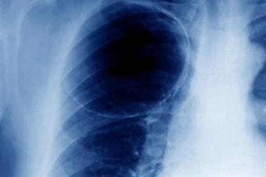COPD: challenge for the NHS (Photograph: SPL)