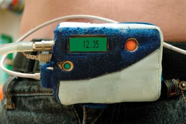 Ambulatory BP monitor: improves hypertension diagnosis (Photograph: SPL)