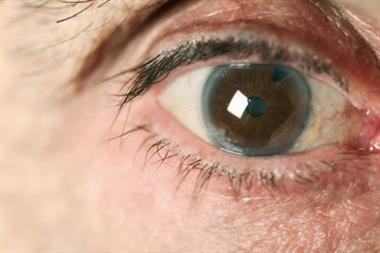 Glaucoma represents a large proportion of the £2bn a year NHS budget for vision services (Photo: iStock)