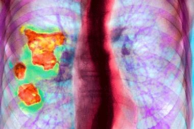 COPD: treatment must improve (Photgraph: Ducane Medical Imaging Ltd)