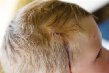 GPs should consider abuse if a child has a head injury in the absence of confirmed accidental trauma (Photograph: SPL)