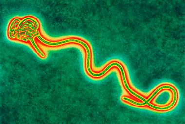 Ebola virus: public health officials urged GPs to be on the lookout for the disease (Photo: SPL)