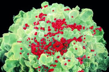 HIV: image shows T-cell infected with the virus (Photo: Science Photo Library)