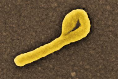 Ebola virus: GPs are urged to stay alert to possible cases in the UK (Photo: SPL)