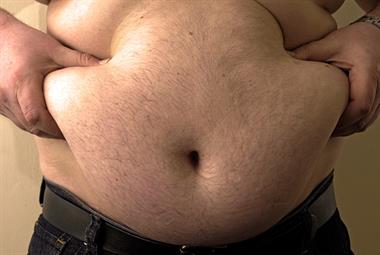 Obesity: link to cancer