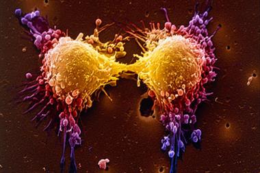 New treatments have helped cut deaths from prostate cancer. Pictured are dividing prostate cancer cells (Photo: SPL)