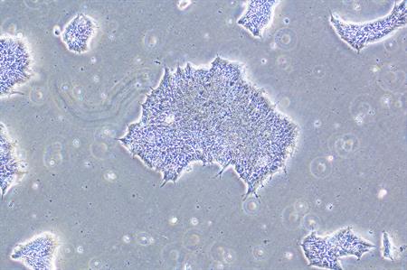 International Society for Stem Cell Research meeting opens in Melbourne