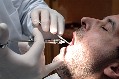 As well as it's use following dental surgery, etoricoxib is also licensed for the treatment of osteoarthritis, rheumatoid arthritis, ankylosing spondylitis, and acute gouty arthritis | SCIENCE PHOTO LIBRARY