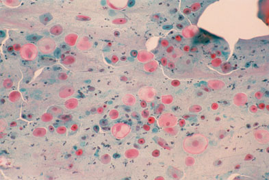 Estriol is still available as a cream for the treatment of atrophic vaginitis (pictured) | SCIENCE PHOTO LIBRARY
