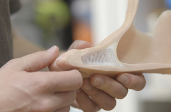 Silicones are essential to prosthetics