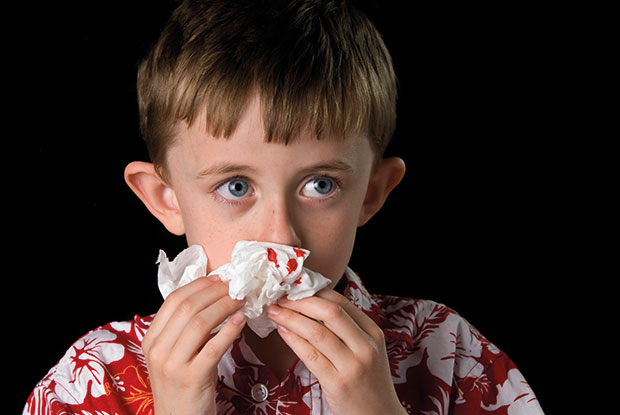 Managing epistaxis in children | GPonline