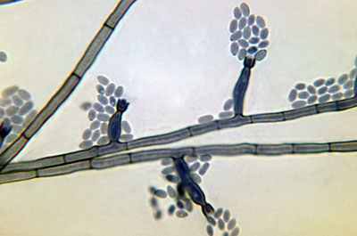 Conidia-laden conidiophores of a Phialophora verrucosa fungal organism