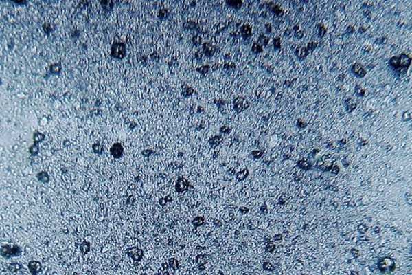 Microplastic spheres in tooth paste, about 30 micrometres in diameter. Photograph: Dantor CC BY-SA 3.0