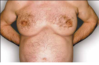 PETA ad campaign urges Scottish men to forgo meat and lose 'Moobs'