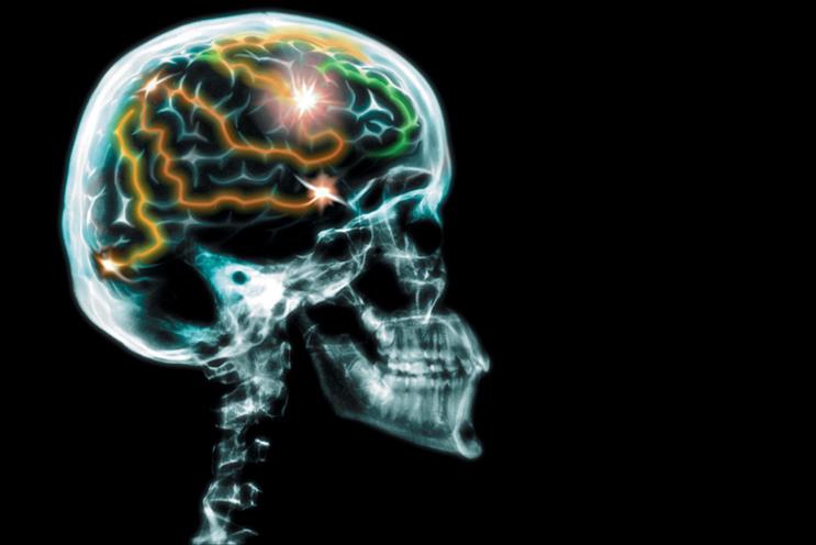 Why shouldn't we use pharmaceutical brain-enhancers