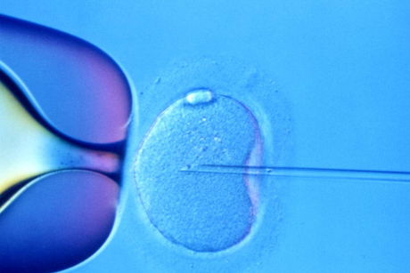 On the Agenda: Women over 40 to be offered IVF