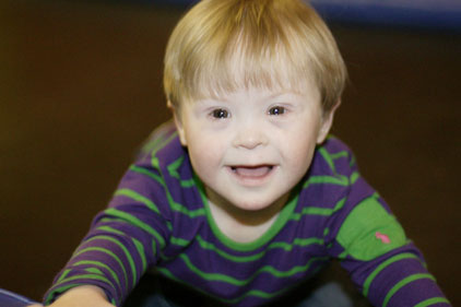 New research: Down's syndrome