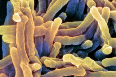 TB cases pose specific challenges (Photograph: SPL)