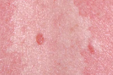 Disadvantages of lesion studies image