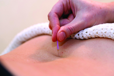 A study indicated that acupuncture is effective in treating chronic pain (Photograph: Dr P Marazzi/SPL)