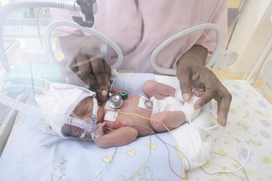 Research highlights the need to understand the link between deprivation and risk of pre-term birth (Photo credit: SPL)