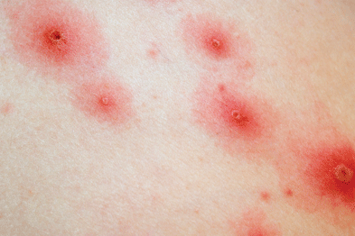 pinpoint red dots on skin itchy groups of 3