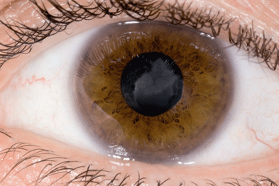 Kettős látás (Diplopia) tünetei és kezelése