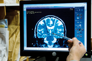Deep brain stimulation is sometimes used as a treatment for primary dystonia (Photograph: SPL)