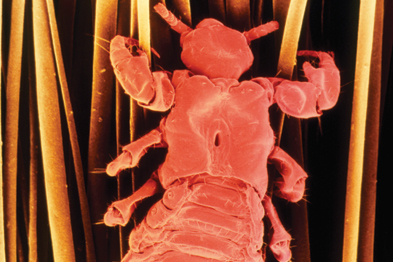 The Basics The Management Of Head Lice Gponline