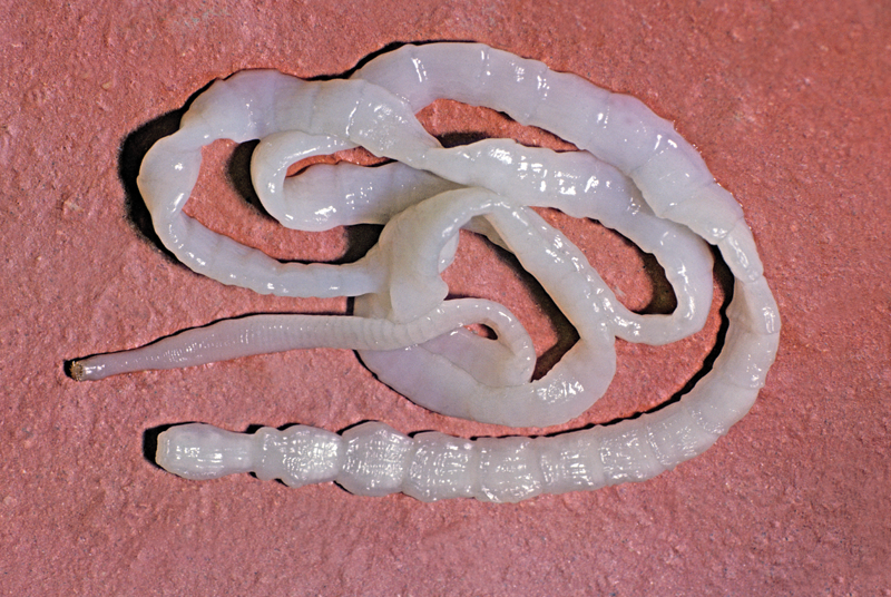 Tapeworm infestation in a returned traveller | GPonline