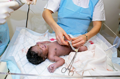 Delaying umbilical cord clamping could cut the risk of iron deficiency (Photograph: AJ Photo/SPL)