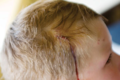 GPs should consider abuse if a child has a head injury in the absence of confirmed accidental trauma (Photograph: SPL)