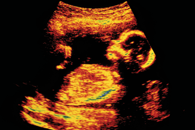 Risk of fetal damage from infection declines to 10-20% at 11-16 weeks