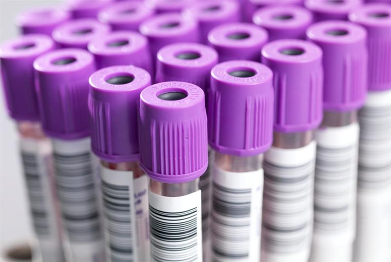 Supply Problem Limiting Nhs Blood Tests To Last Significant Period Of Time Gponline