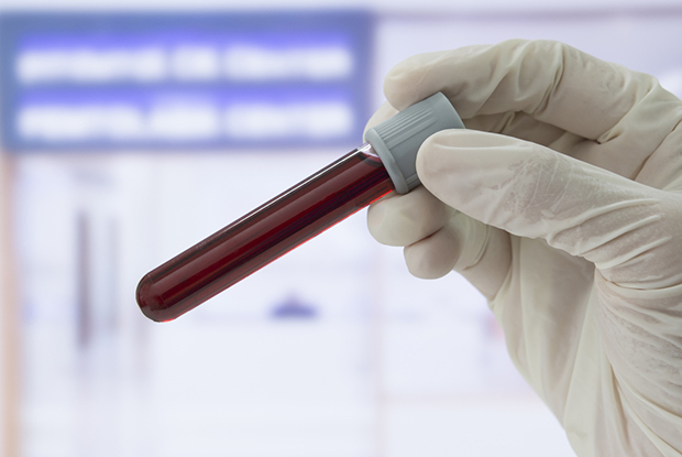 GPs told to test all patients with one or more blood cancer symptoms ...