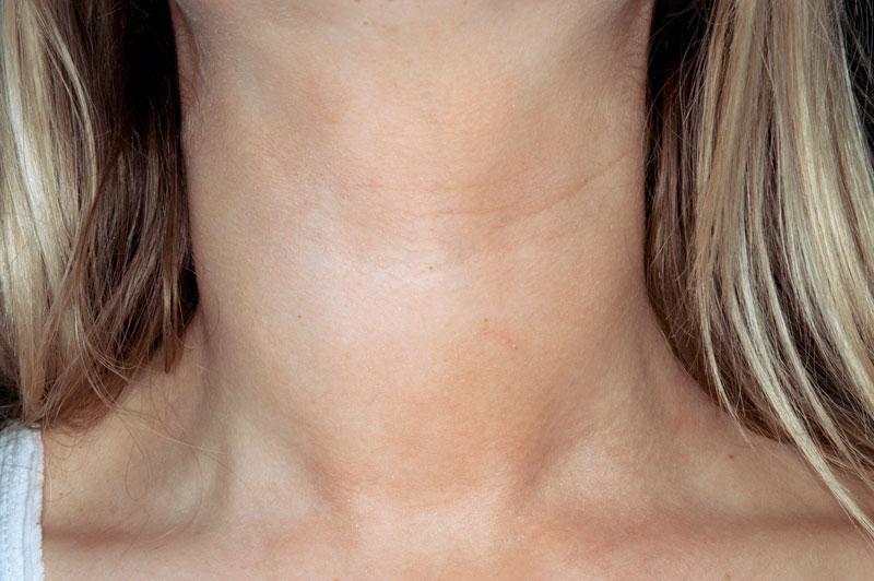 clinical-review-hypothyroidism-gponline